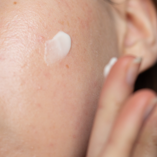 Five Retinoid Myths Debunked