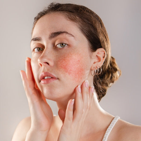 The Problem With Skincare Overload