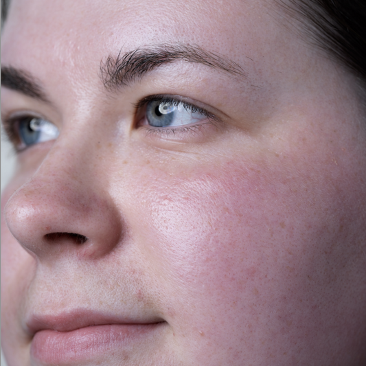 Is Your Skin Sensitive or Sensitised? How to Understand the Difference.