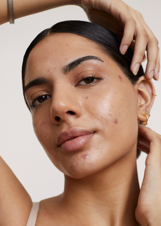 What’s the Obsession With Tretinoin? Why the ‘Holy Grail’ Isn’t the Right Retinoid for Everyone