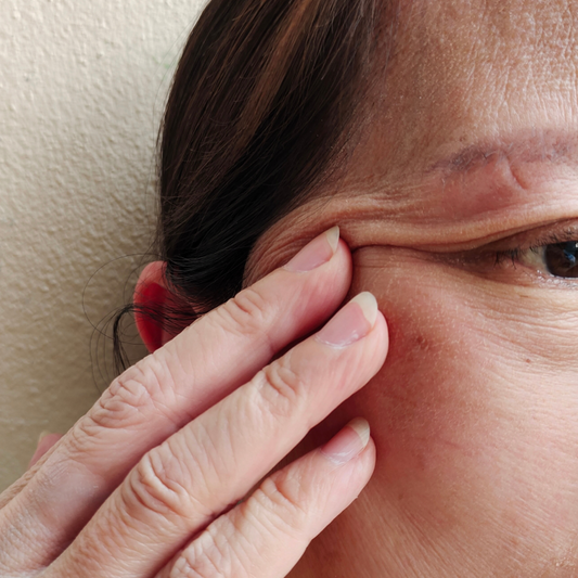 Ozempic Skin – Managing the Effects of Rapid Weight Loss