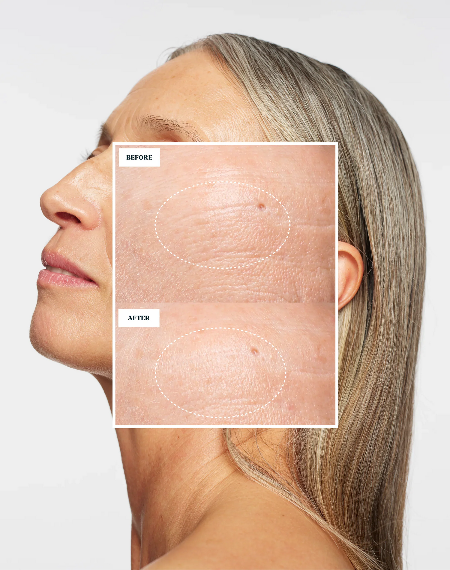 Skin Rocks by Caroline Hirons | Before and after skincare results showing smoother, clearer skin texture