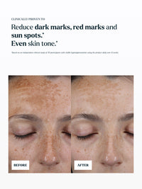 The Hyperpigmentation Serum Refill