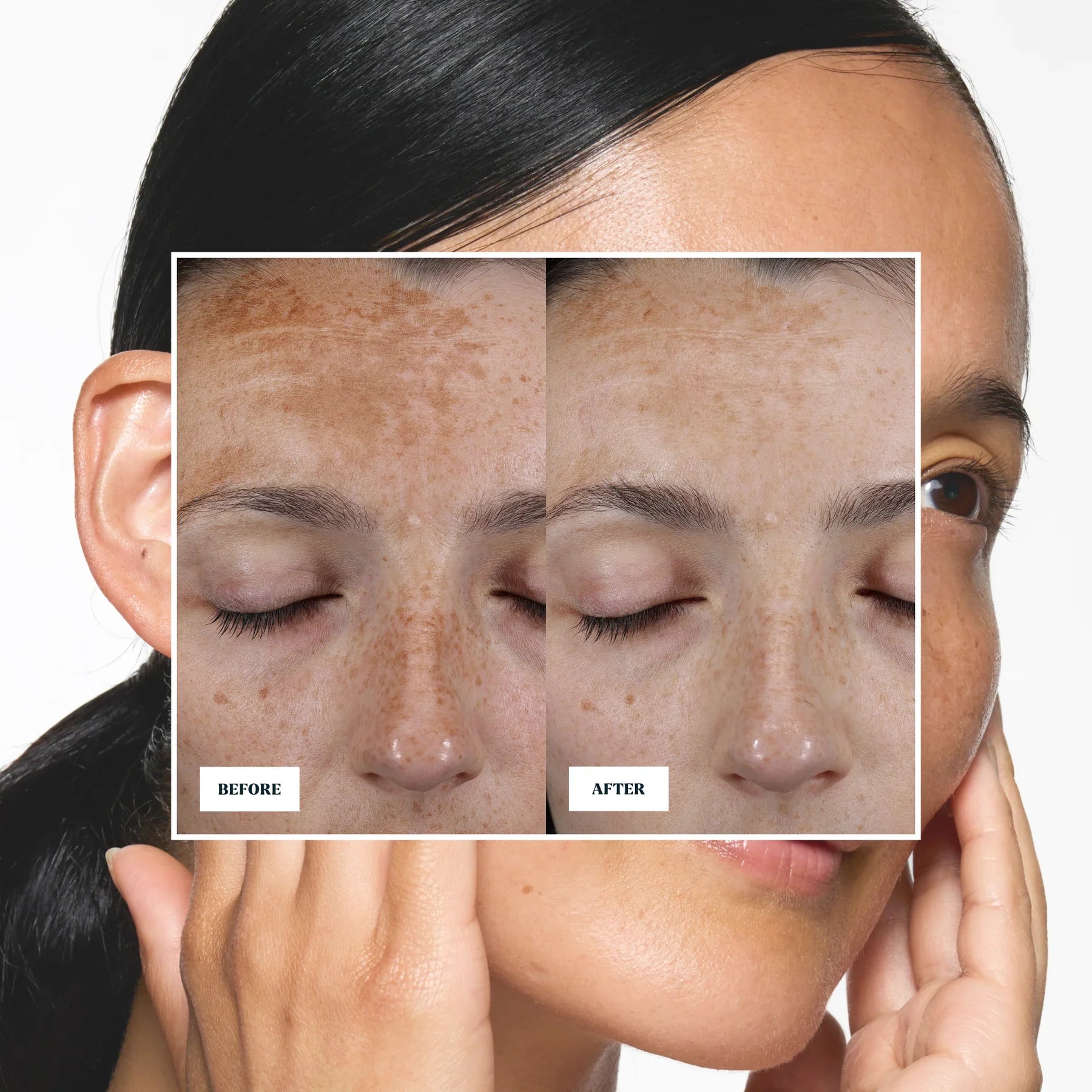 Skin Rocks by Caroline Hirons | Before and after skincare results showing reduced hyperpigmentation and brighter skin tone