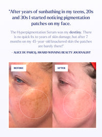 The Hyperpigmentation Serum