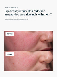 The Support Serum Refill